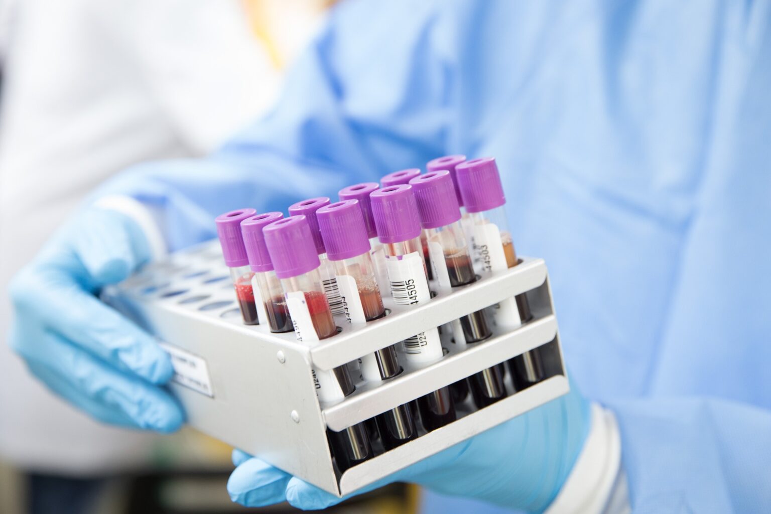 routine-blood-test-may-detect-cancer-physicians-news